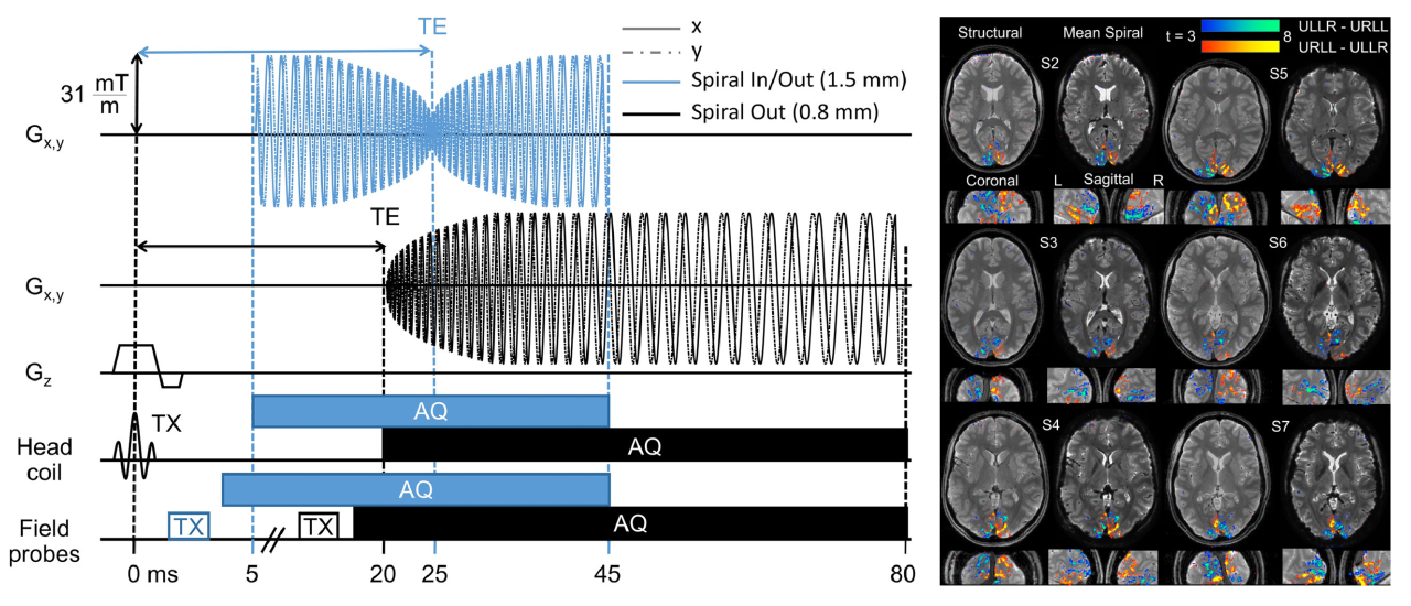 Utilized 2D single-shot spiral acquisitions